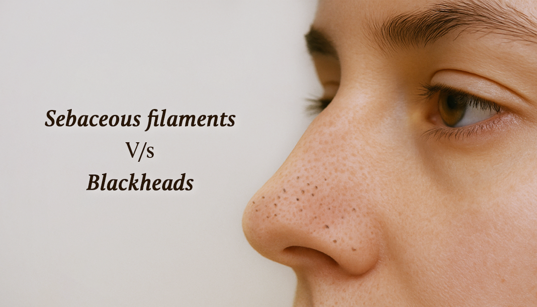 Blackheads vs sebaceous filaments