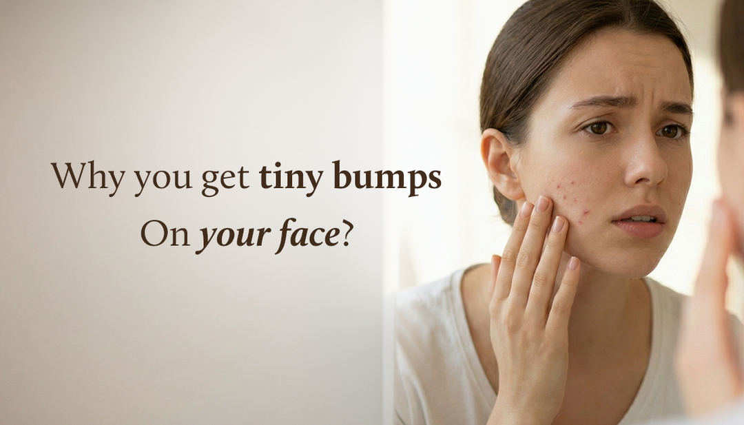 Tiny bumps on face