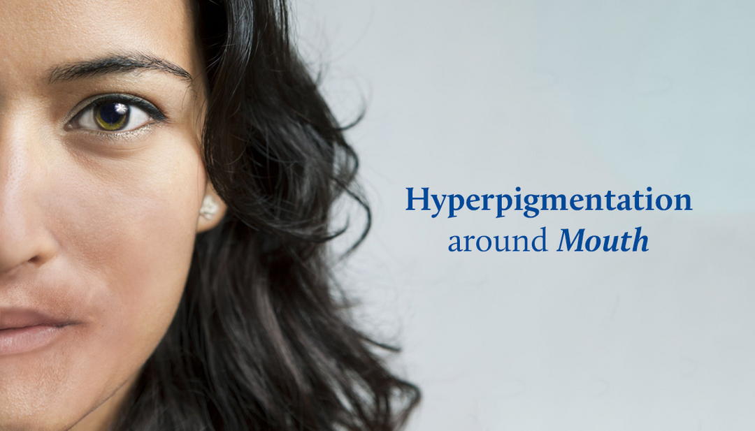 What causes hyperpigmentation around mouth?