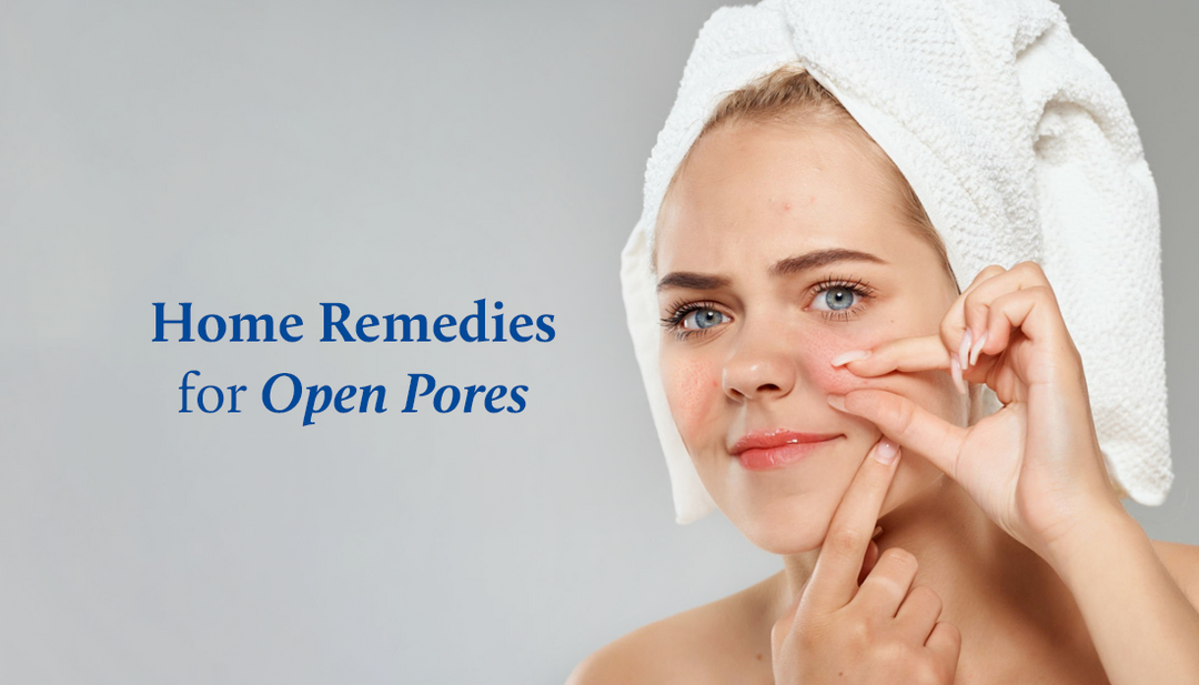 Home Remedies for Open Pores