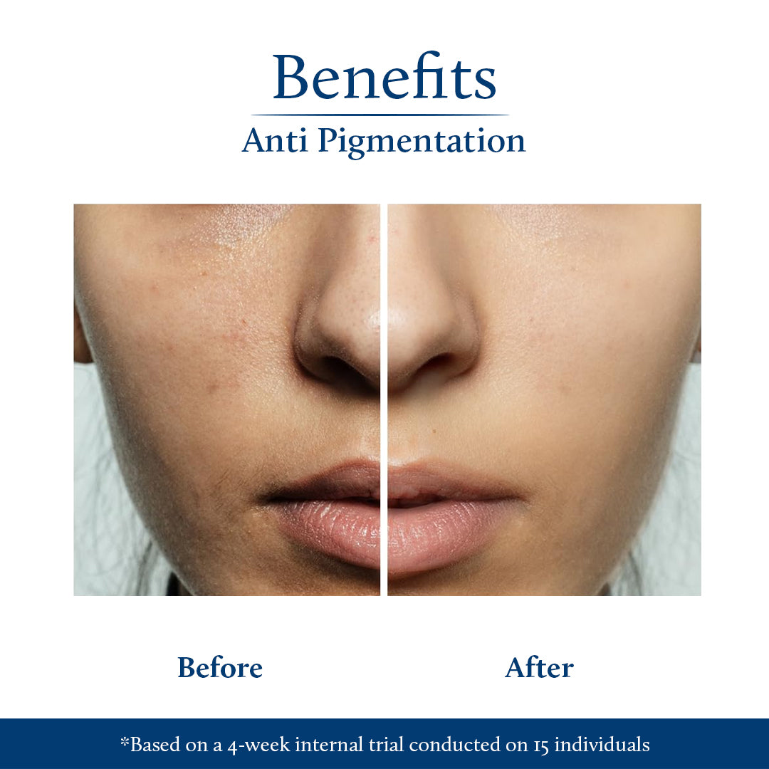 Applying kojic acid before and after results