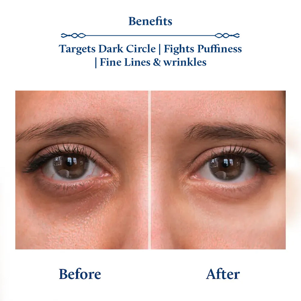 Papaya & Potato starch under eye cream for dark circles, puffiness, fine lines & wrinkles
